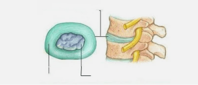 The nature of osteochondrosis
