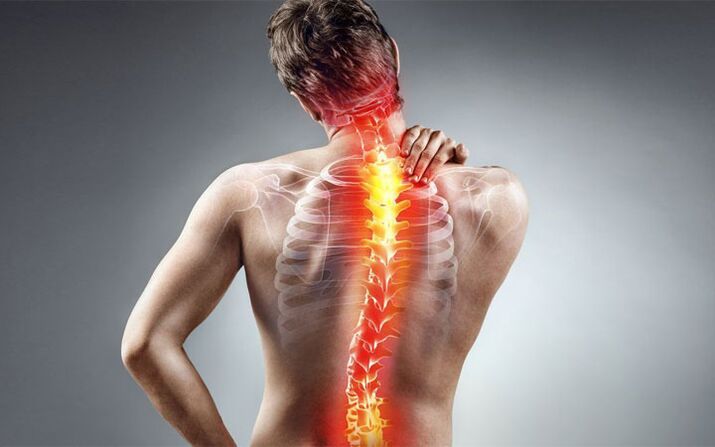 Back pain with scoliosis