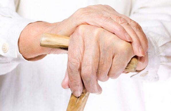arthrosis of fingers in an adult